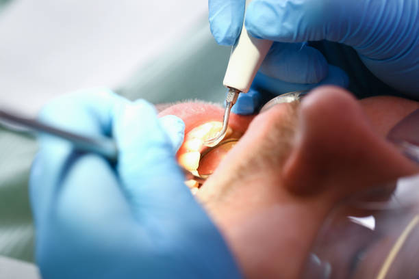 Best Holiday Emergency Dentist in Mount Morris, MI