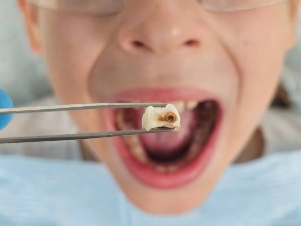 Best Orthodontic Emergency Dentist in Mount Morris, MI