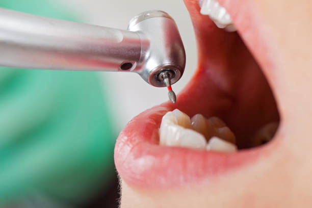 Best Emergency Dentist for Knocked-Out Tooth in Mount Morris, MI
